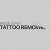 Fresh Start Lazer Tattoo Removal