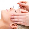 Acupuncture Eastbourne